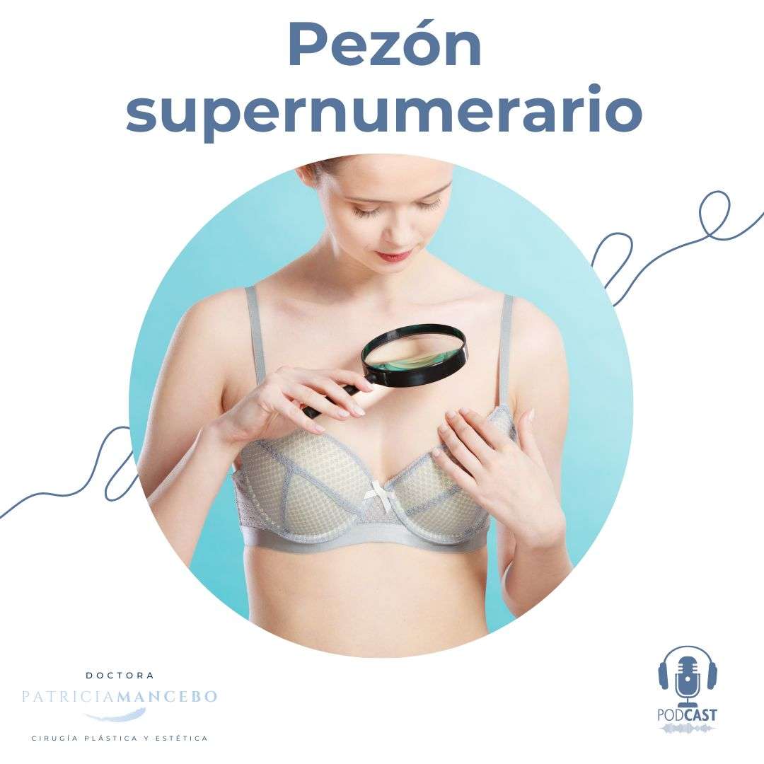 Extirpación de Pezón Supernumerario