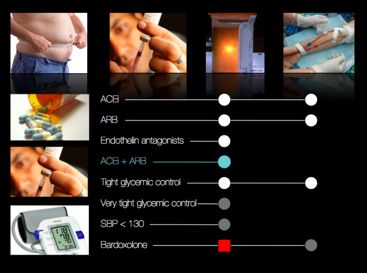 Diabetic Nephropathy with a focus on proteinuria as a poor prognostic