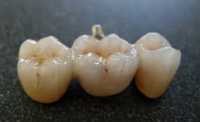 Pearwoodsmiles