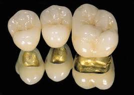 Pearwoodsmiles