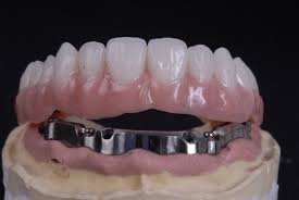 Pearwoodsmiles