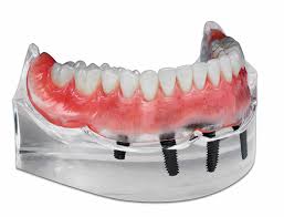 Pearwoodsmiles