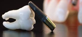 Pearwoodsmiles