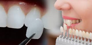 Pearwoodsmiles