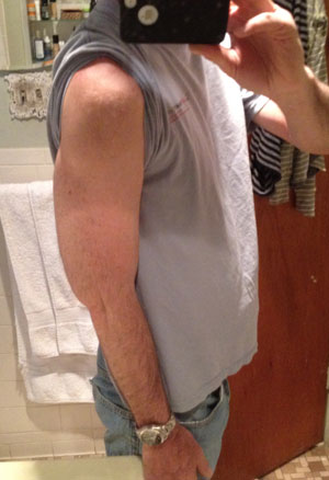 Arm