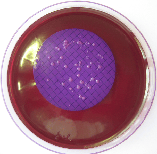 Difference Between Faecal and Non Faecal Coliforms - Pediaa.Com