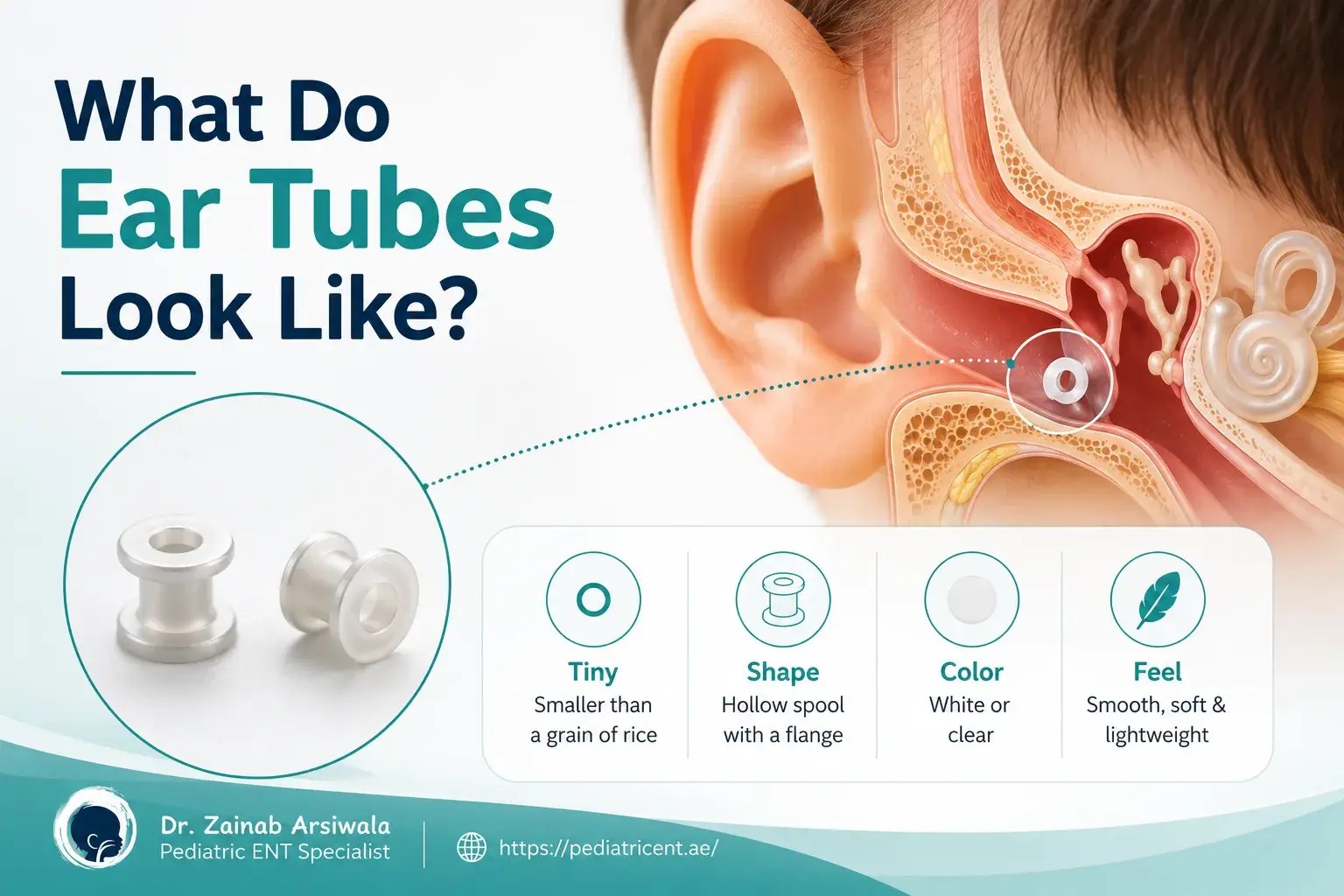 What Do Ear Tubes Look Like