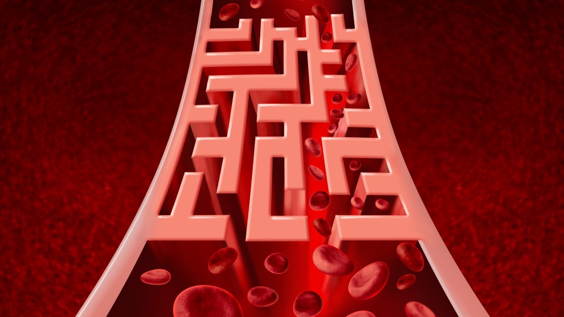 Blood,Circulation,Problems,And,Blocked,Arteries,Health,Care,Concept,With