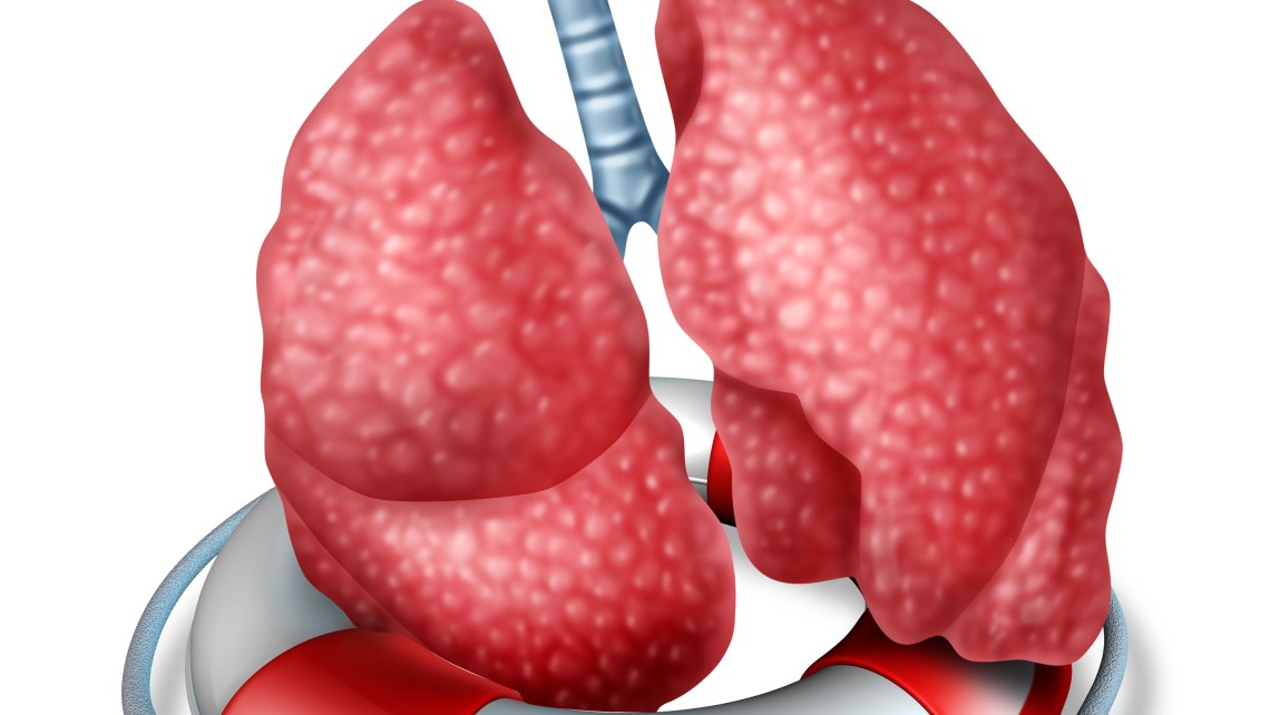 Lungs,Rescue,Medical,Health,Care,Concept,With,The,Human,Lung
