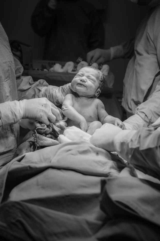 A newborn baby in a hospital delivery room, surrounded by medical practitioners during childbirth.