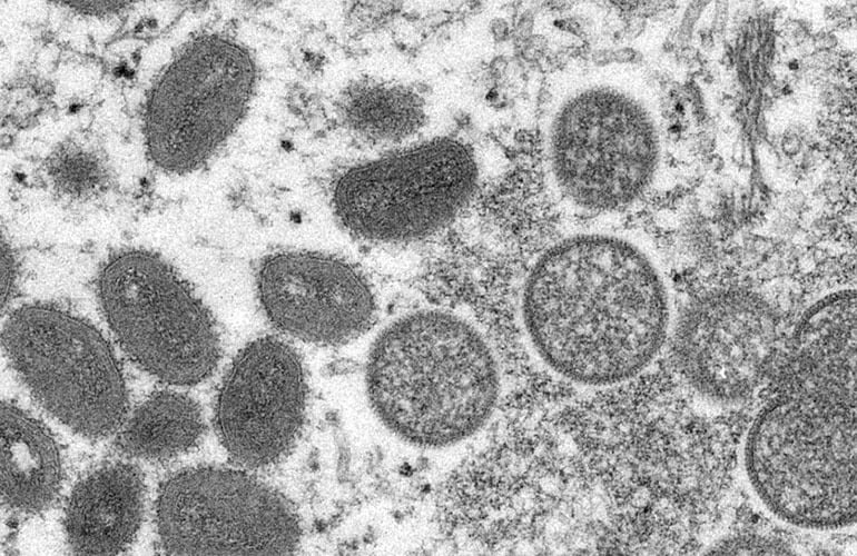 اخرین بروز رسانی ابله میمون در کانادا