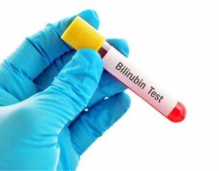 Bilirubin, Direct