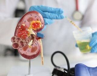 Kidney Function Test (KFT)