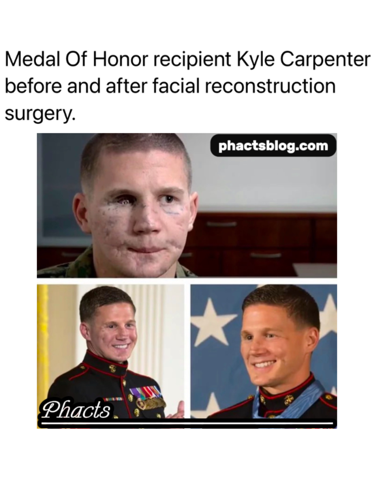 Kyle Carpenter: The Marine Who Risked It All and Defied the Odds