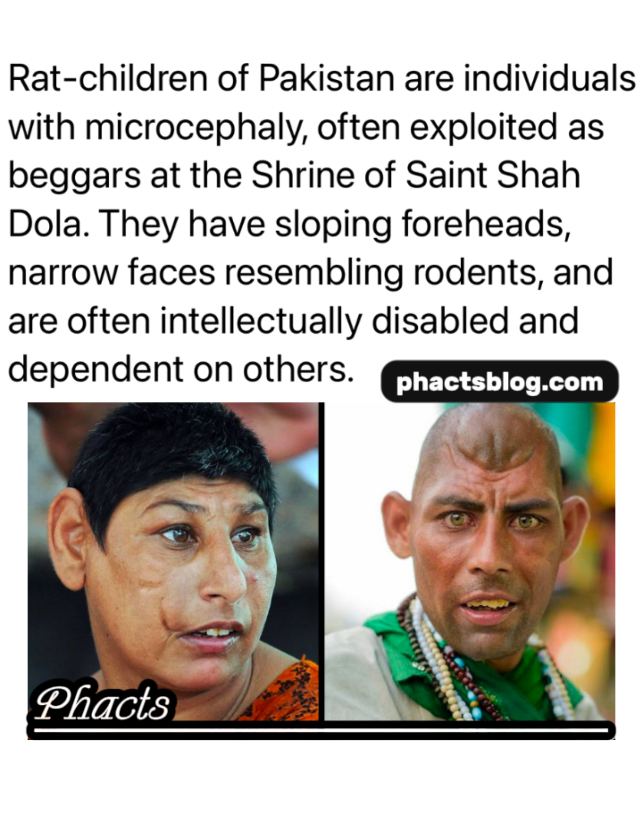 History of Pakistan’s “Rat Children” and the Shrine of Shah Dola