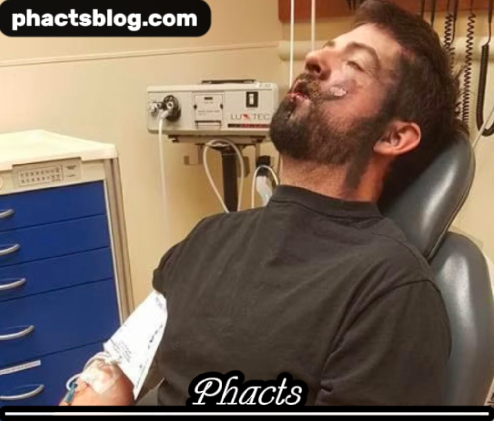 Andrew Hall’s Shocking E-Cigarette Explosion