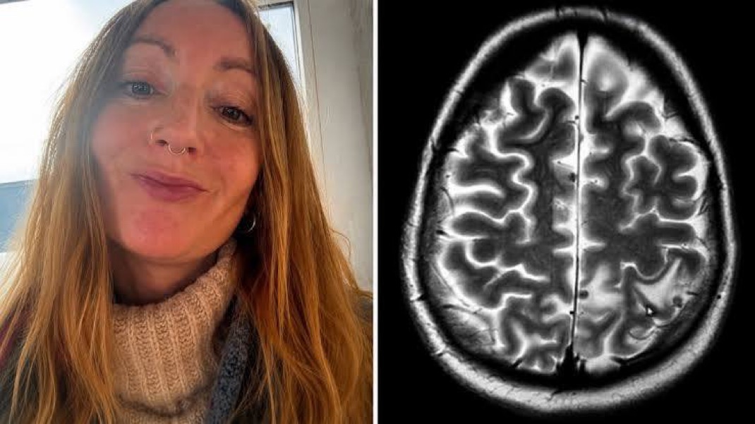 Lowri Denman Avoided Meat in India but Ended Up with 38 Parasites in Her Brain