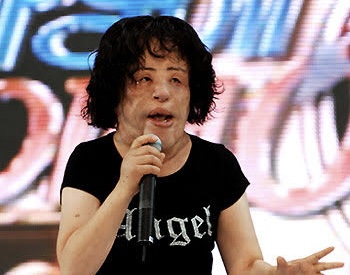 Hang Mioku Injected Cooking Oil Into Her Face After Plastic Surgery Addiction