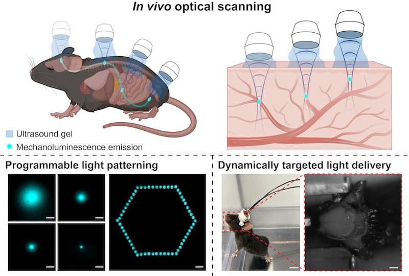 Ultrasound-Activated Nanoparticles: A Revolutionary Light Source for Medical Treatments (2026)