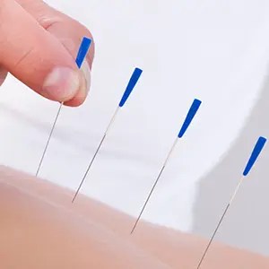 Dry-needling-PhysioPerform-servicess