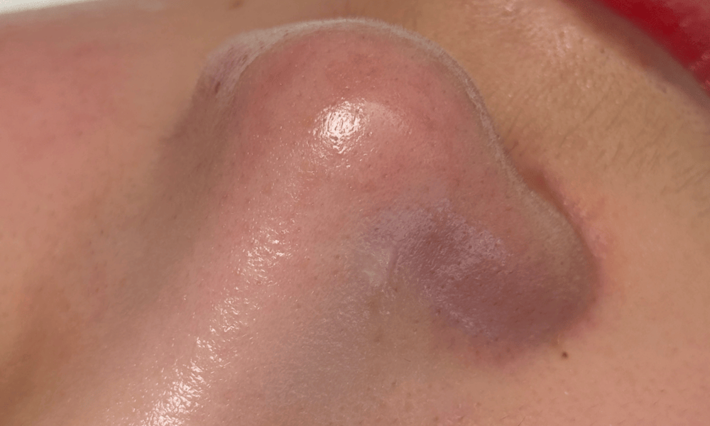 skin4