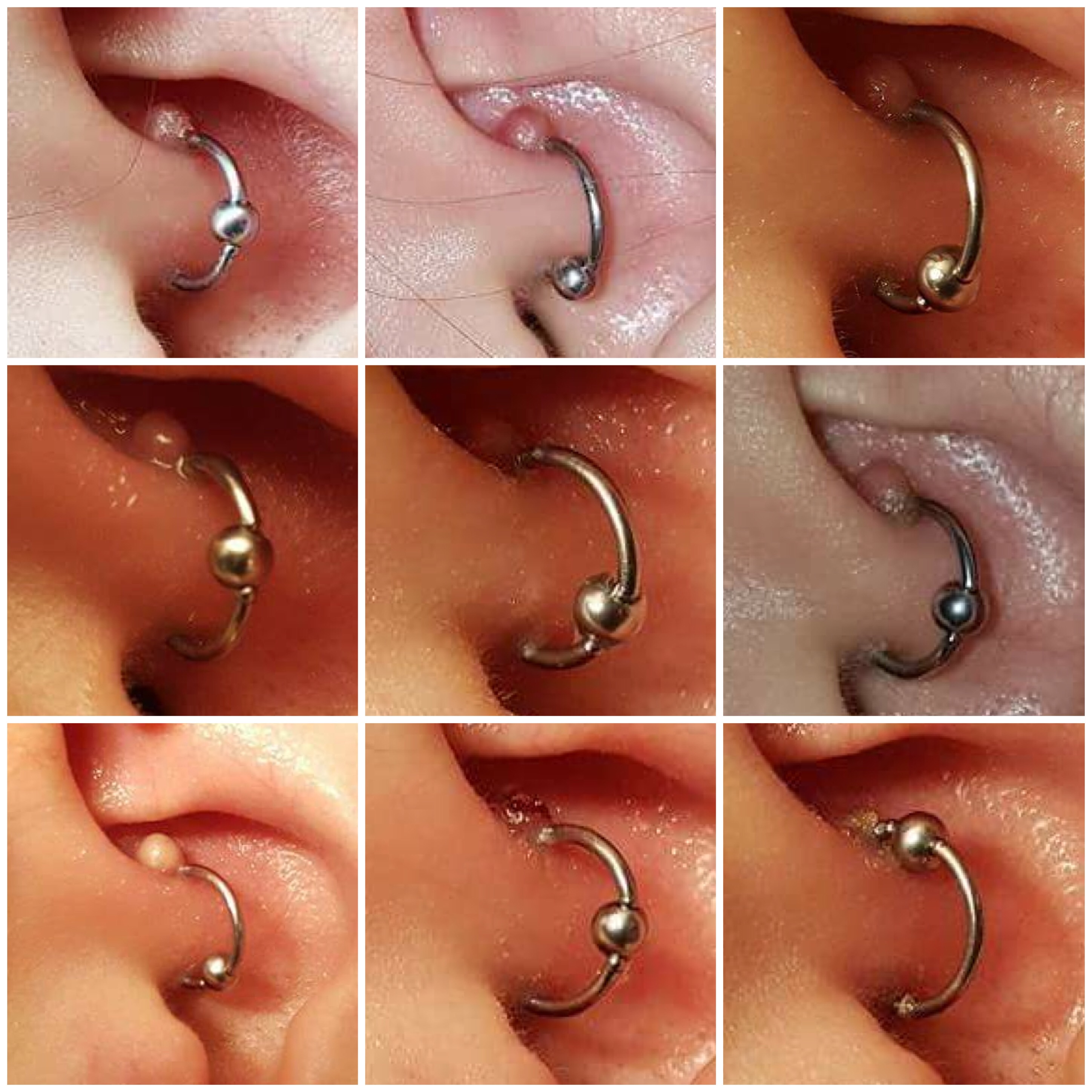 Beauty Tip 5 Tea Tree Oil A Beauty And The Business