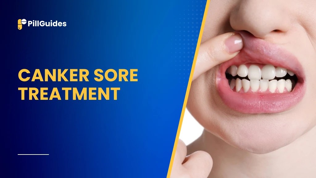 Canker sore treatment: effective solutions for soothing pain and