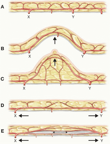 The Blood Supply of the Skin and Skin Flaps | Plastic Surgery Key