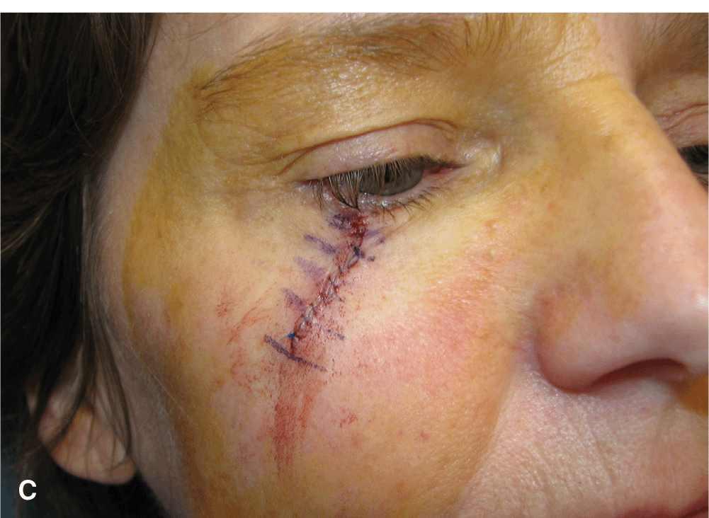 Introduction | Plastic Surgery Key