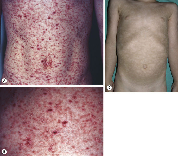 General Dermatology Plastic Surgery Key