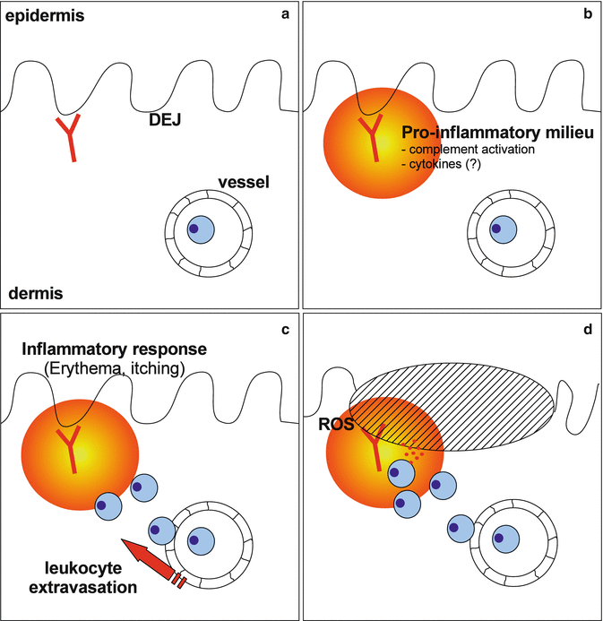Pathogenesis of Epidermolysis Bullosa Acquisita | Plastic Surgery Key