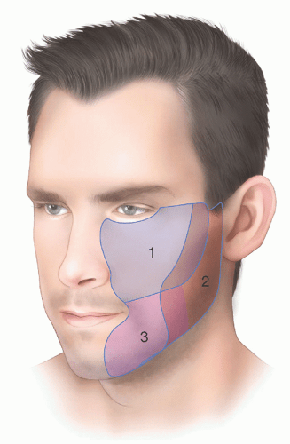 Cheek Reconstruction With Skin Grafts Plastic Surgery Key