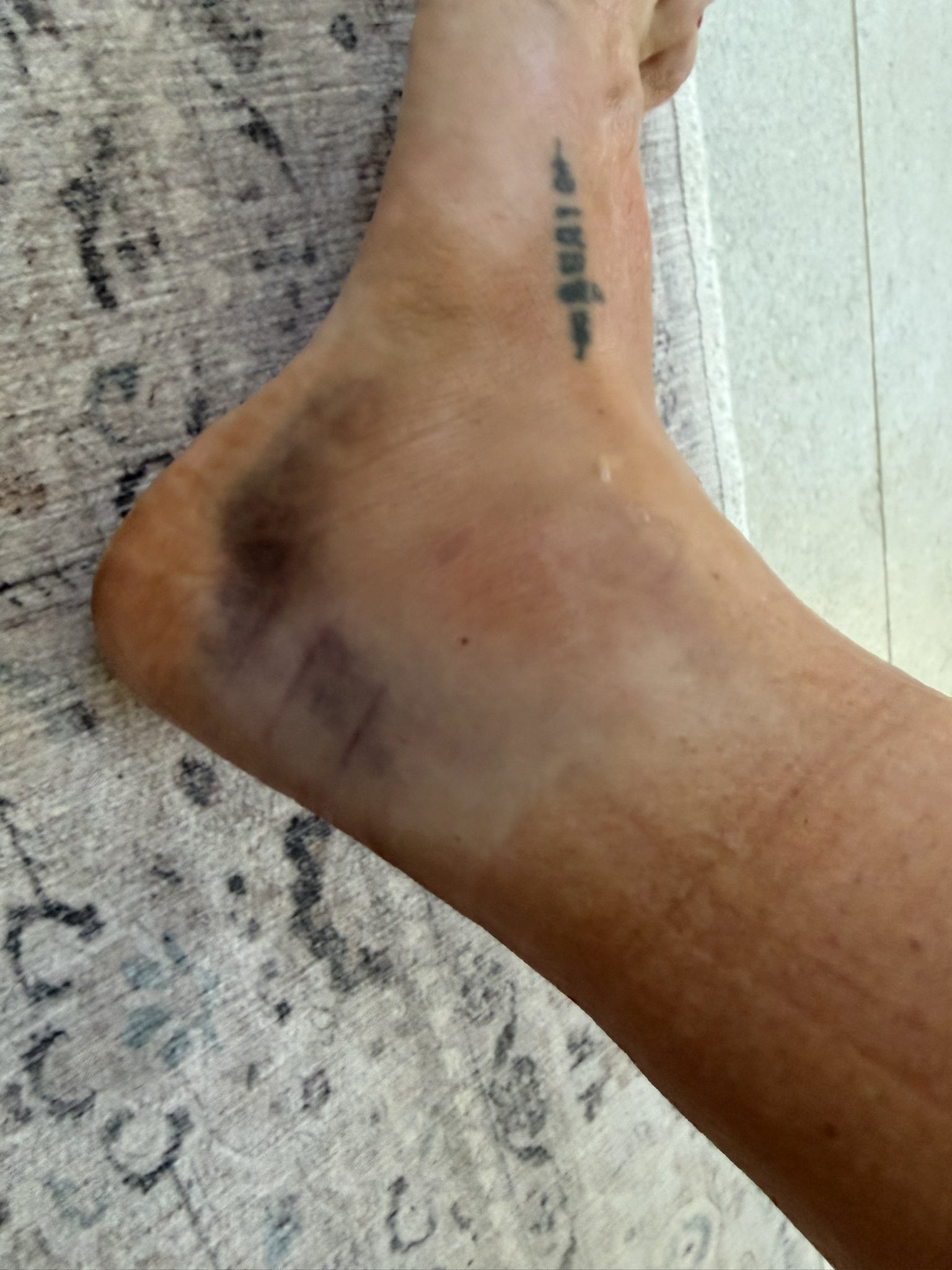 Chelsea Green's Broken Ankle: Fact or Fiction? WWE Injury Update 2026 (2026)