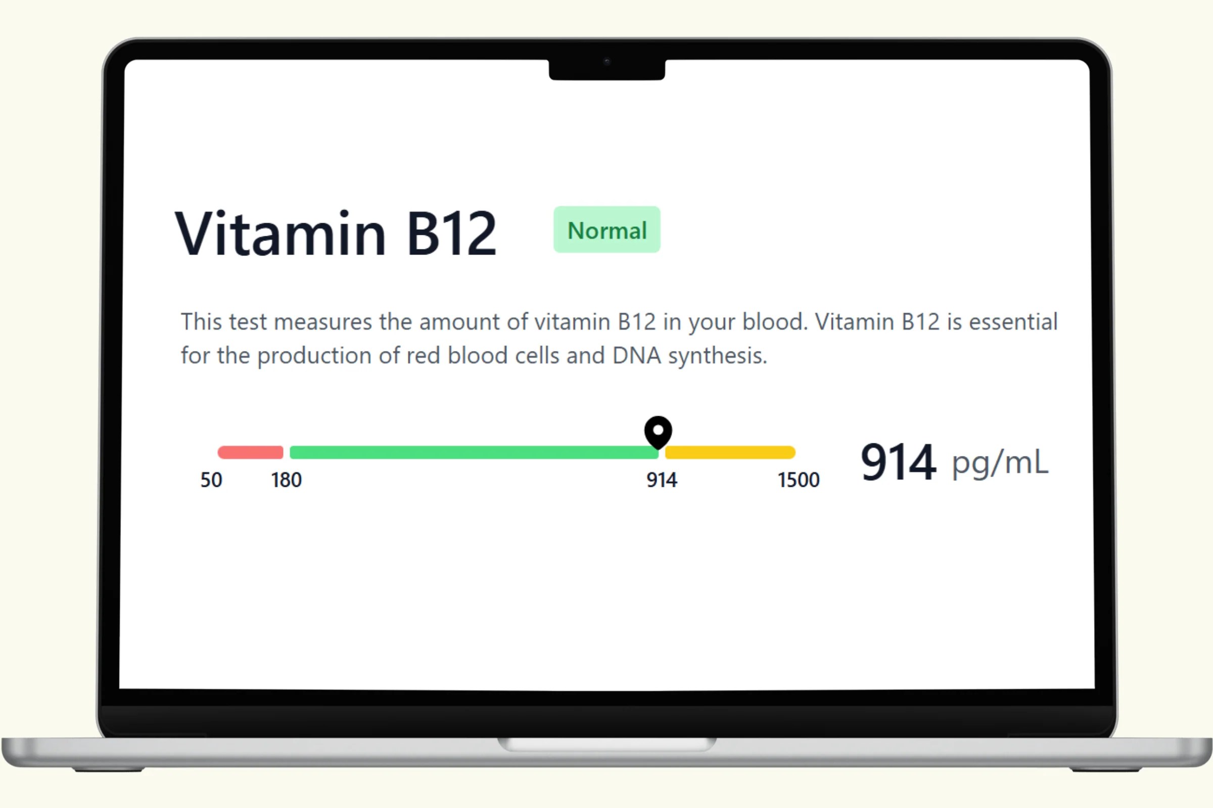 Vitamin B12 Blood Test Methylation Panel Plexusdx