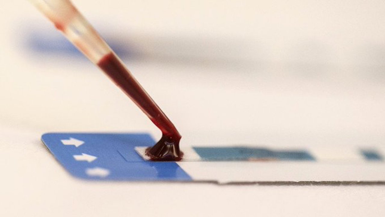 Nueva cepa del VIH científicos aseguran que es la primera en 20 años