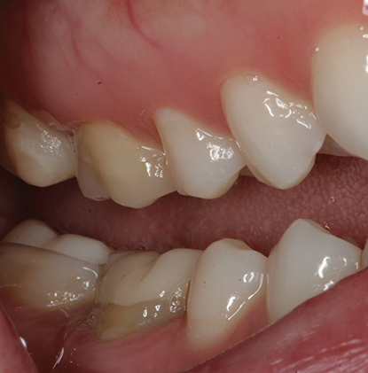 Image described by caption.