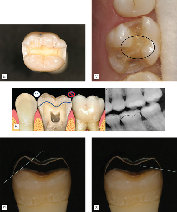 Image described by caption.