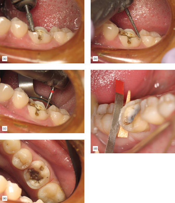 Image described by caption.