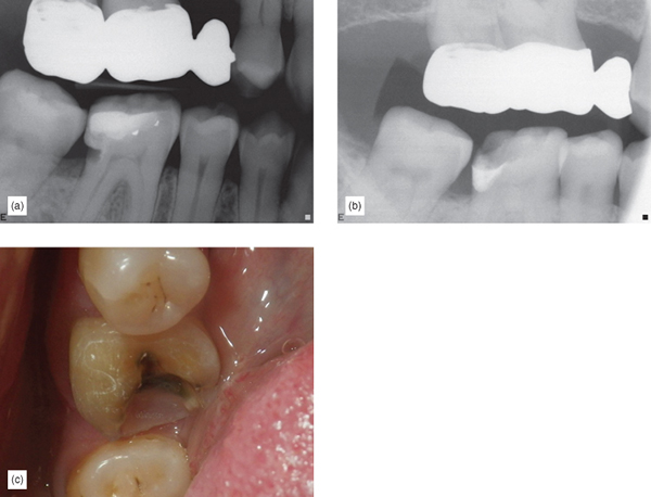 Image described by caption.