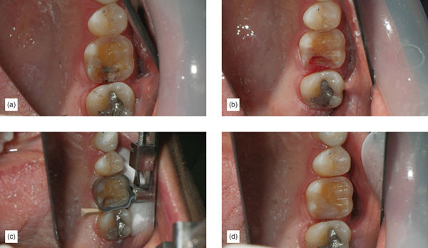 Image described by caption.