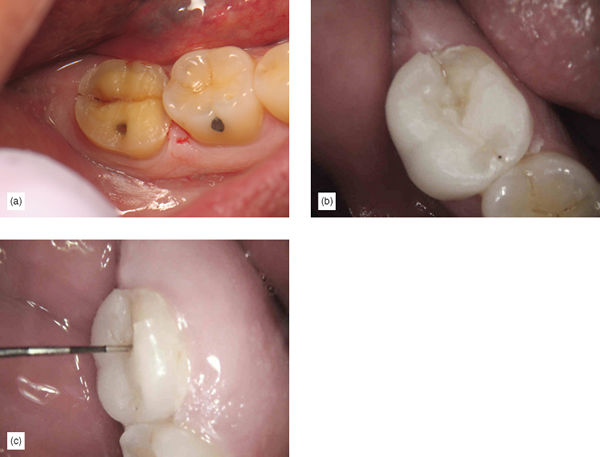 Image described by caption.