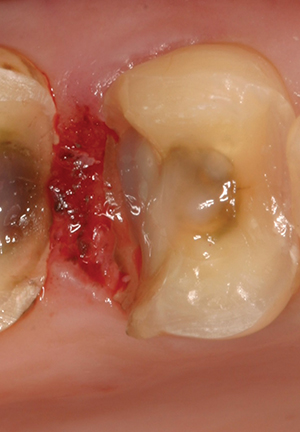 Image described by caption.