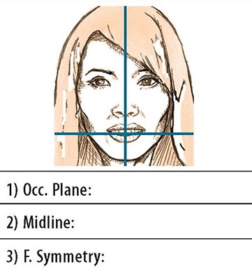 Diagram shows closed-up view of patient’s front full face smile, occlusal plane, where use of facebow-mounted cast helps in laboratory communication and correction.