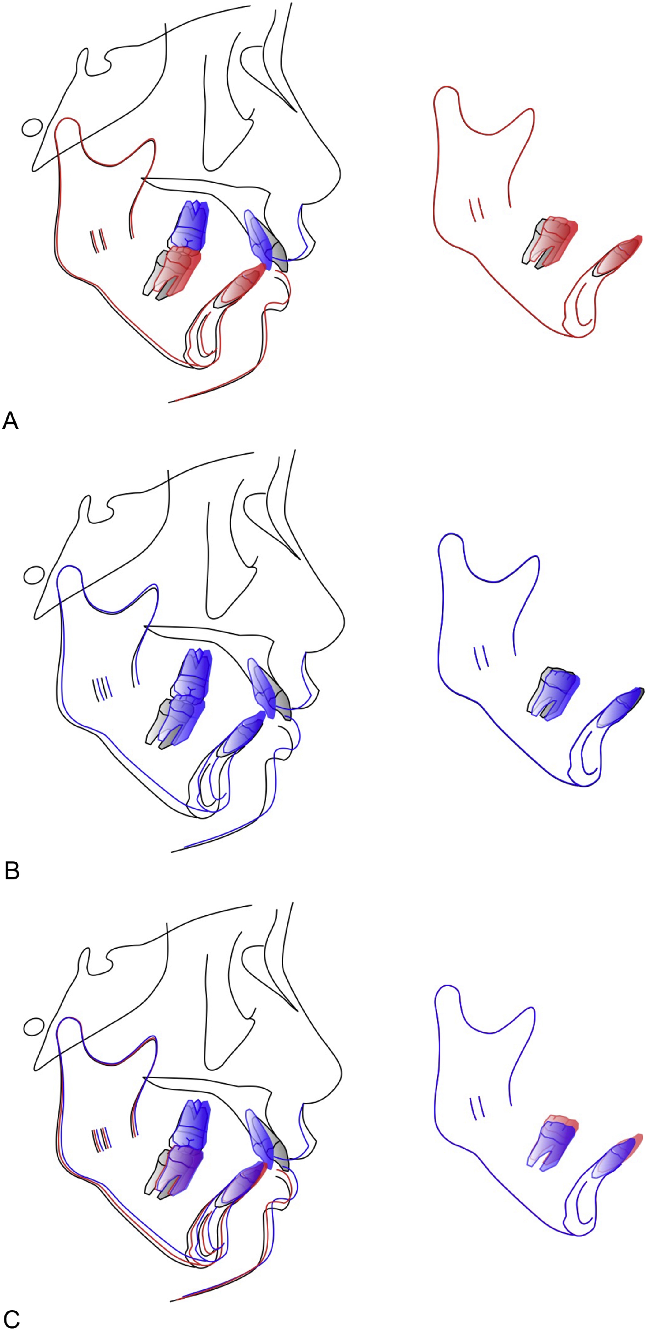 Protocols for orthodontic treatment of patients with temporomandibular ...