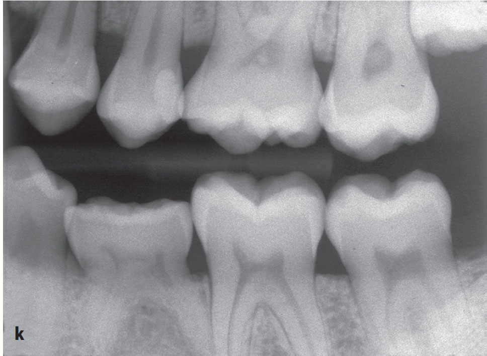 Clinical Cases | Pocket Dentistry