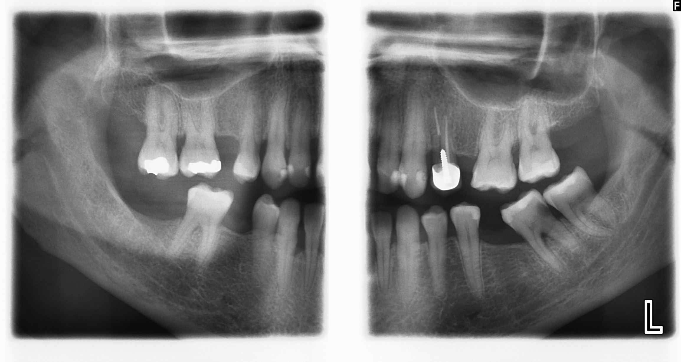 Radiographic Interpretation in Oral Medicine and Hospital Dental ...