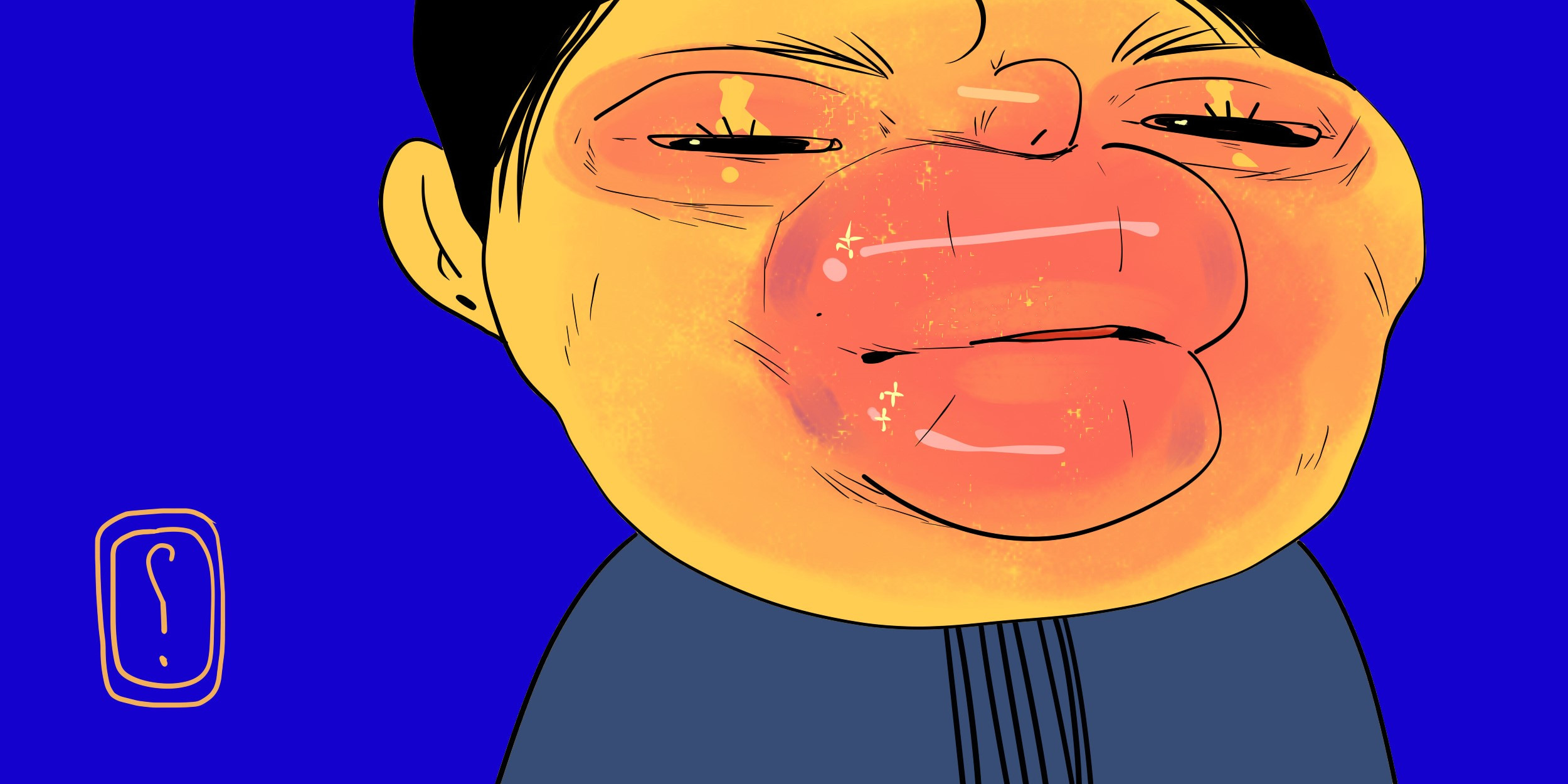 Ангионевротический отек – Симптомы и первая помощь