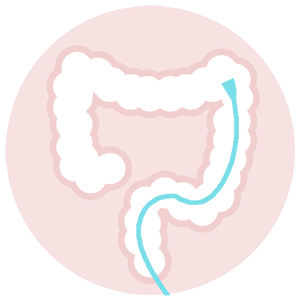 Colonoscopy
