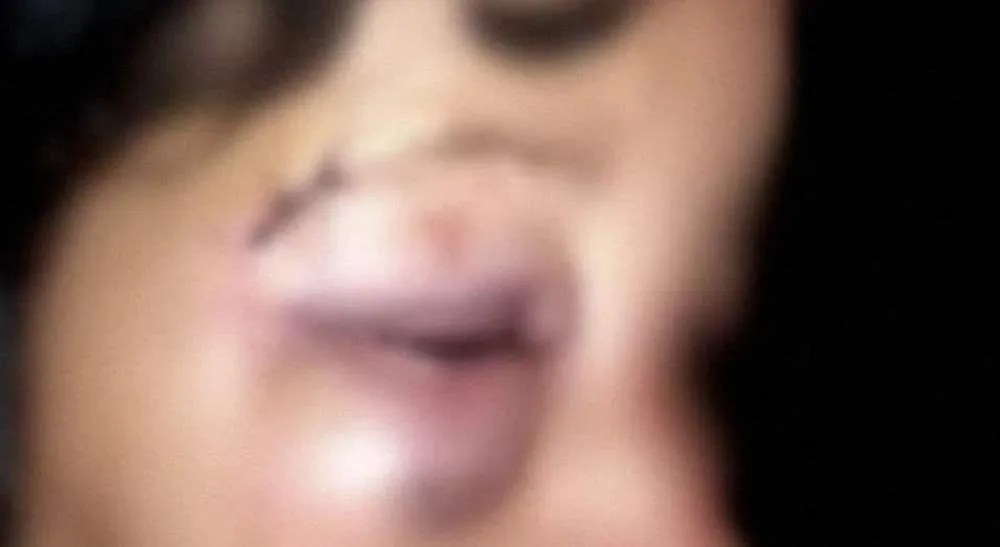 Marido bate na esposa por fazer arroz e feijão para o jantar