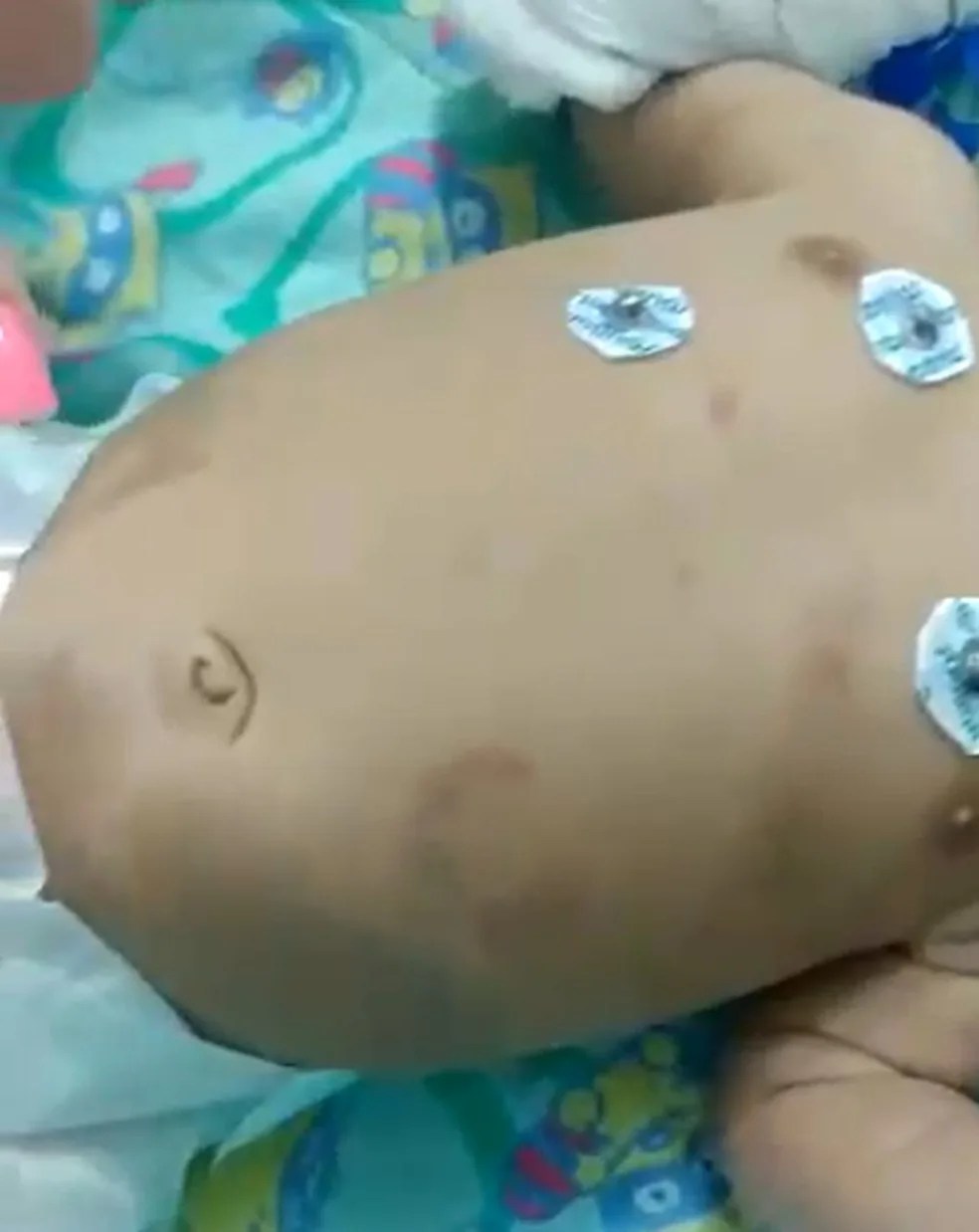 Bebê de 2 meses fica em estado grave após ser espancado pelo pai por ‘chorar demais’